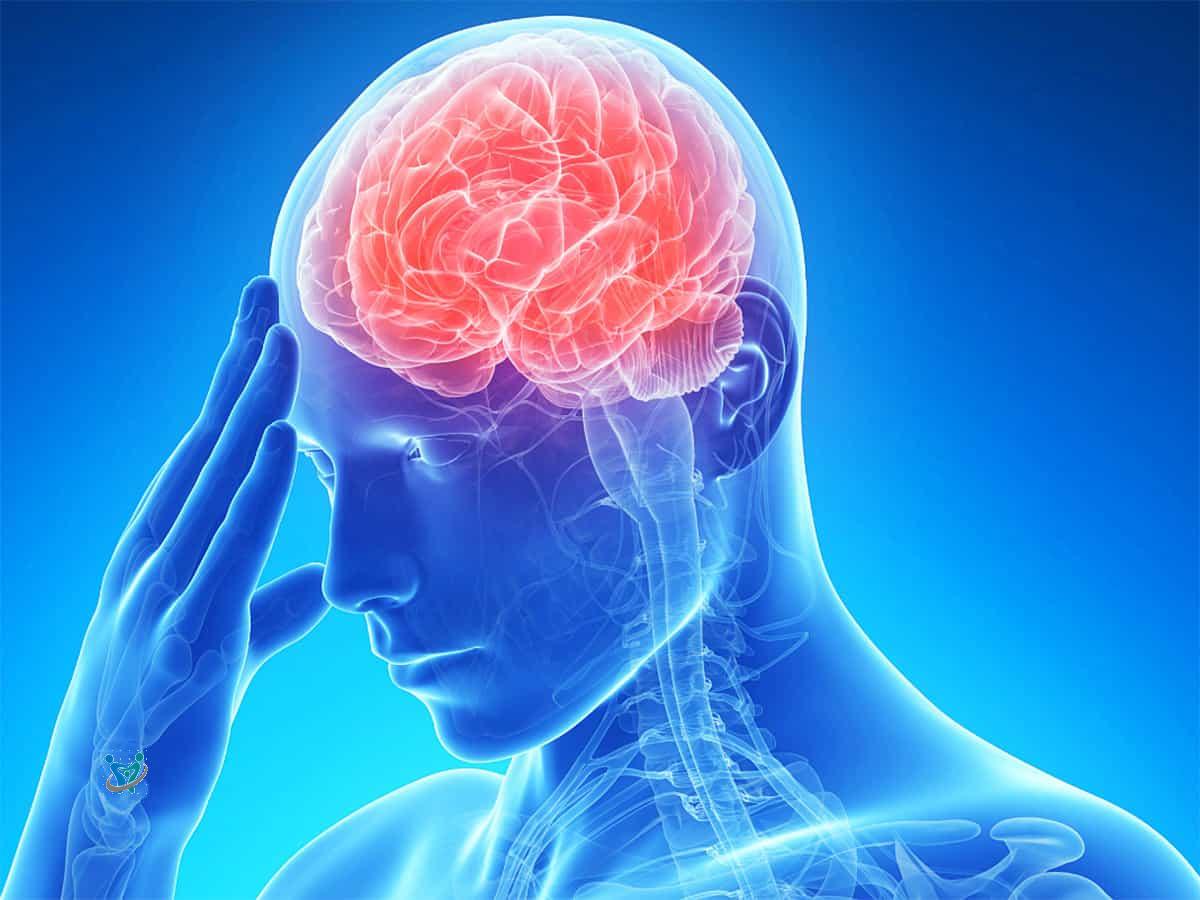 5 معلومات مهمة عن السكتة الدماغية