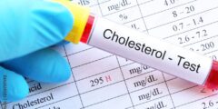 ارتفاع الكوليسترول اسبابه وطرق الوقاية 3 ارتفاع الكوليسترول اسبابه وطرق الوقاية