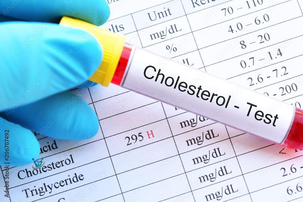 ارتفاع الكوليسترول اسبابه وطرق الوقاية